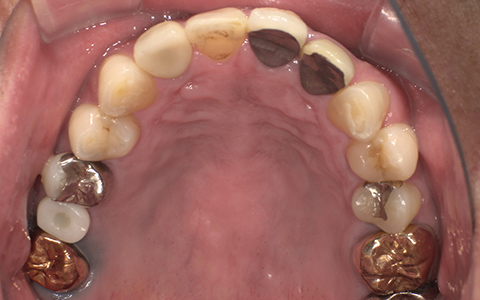 After image