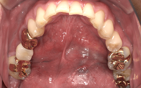 After image