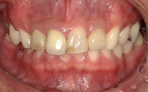 Before image
