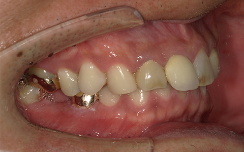 Before image