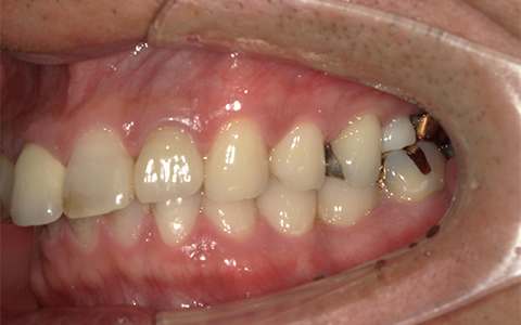Before image