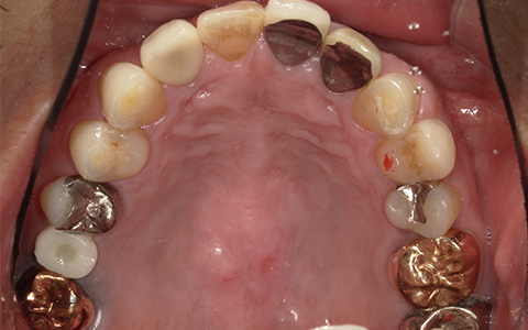 Before image