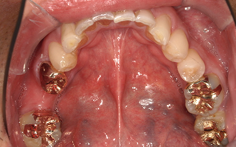 Before image