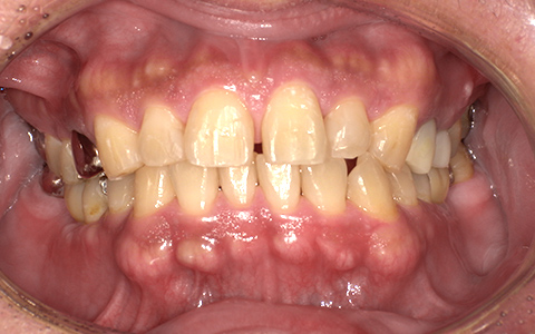 After image