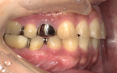 After image