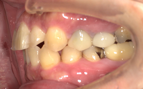 After image