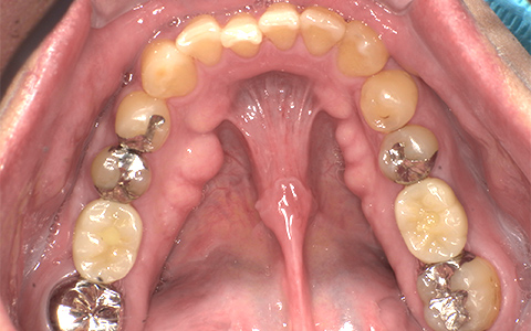 After image