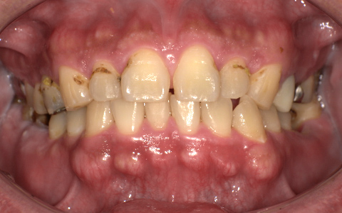 Before image