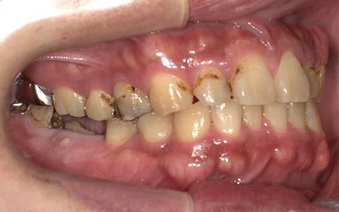 Before image
