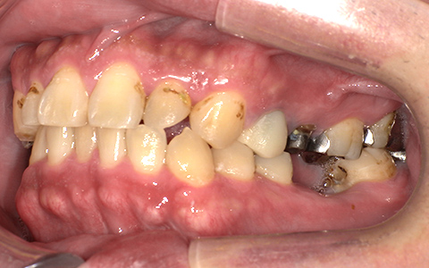 Before image