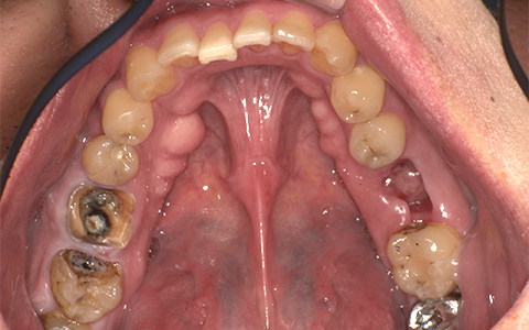 Before image