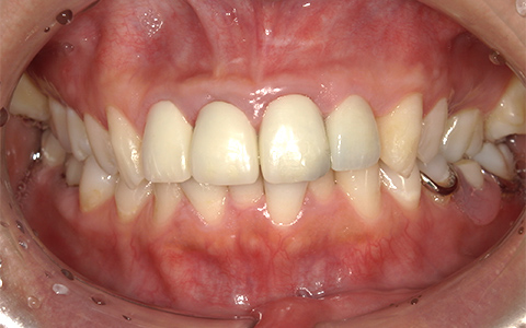 After image