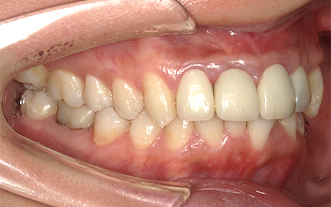 After image