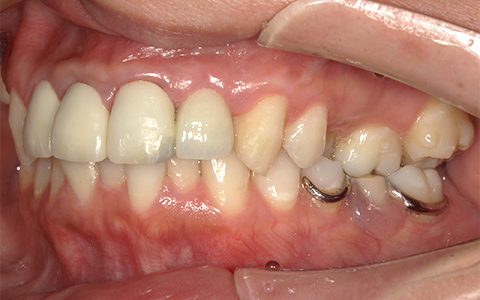 After image