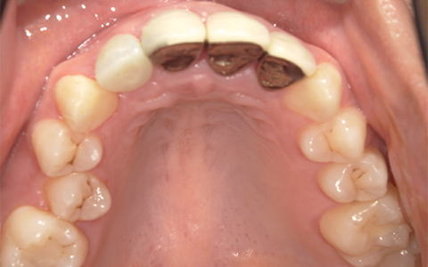 After image