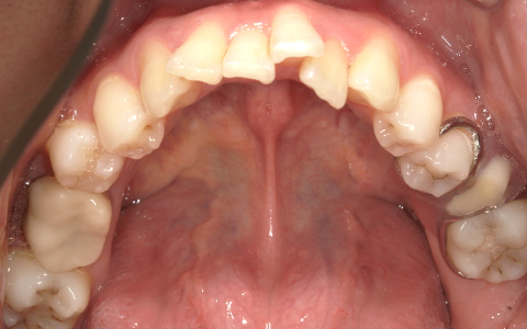After image