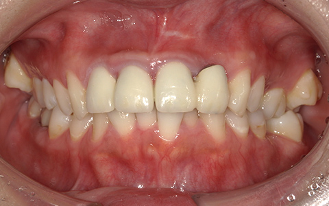 Before image
