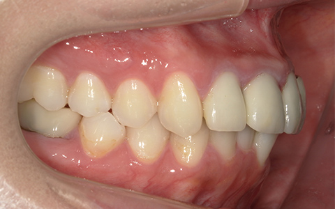 Before image