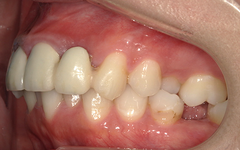 Before image