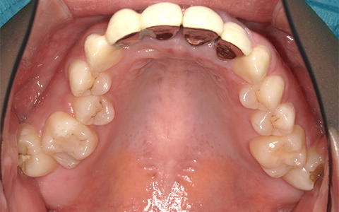 Before image