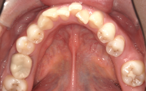 Before image