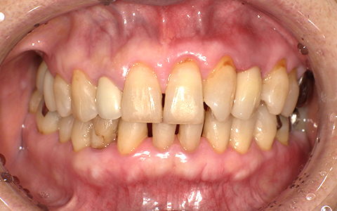 After image