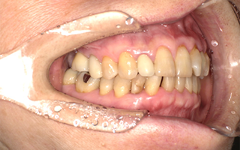 After image