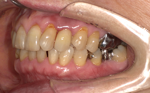 After image