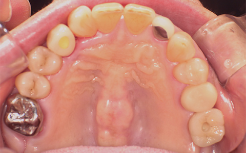 After image