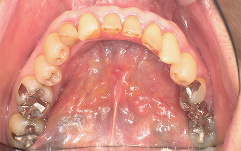 After image