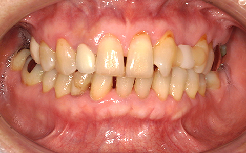 Before image