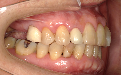 Before image