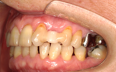 Before image