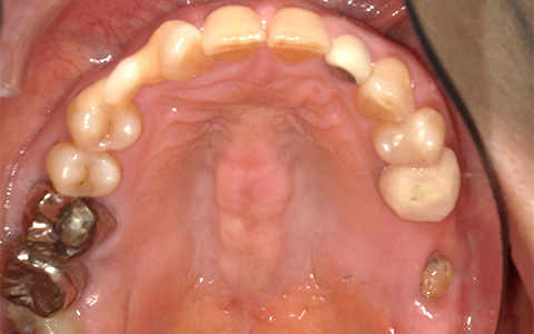 Before image
