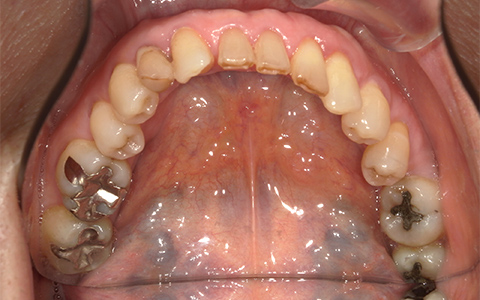 Before image