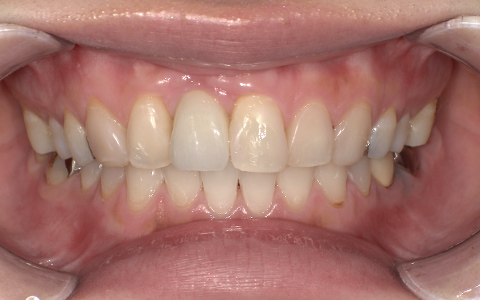 After image