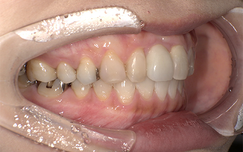 After image