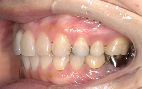 After image