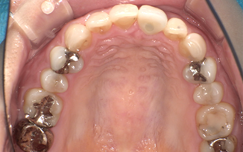 After image