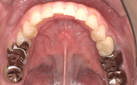 After image