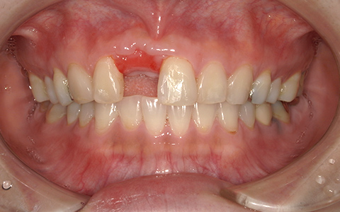 Before image