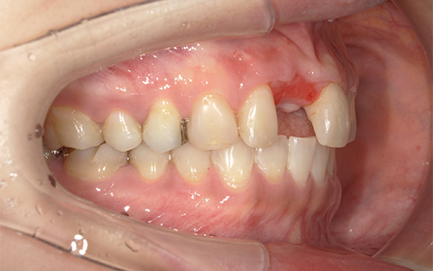 Before image