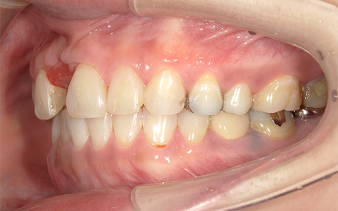 Before image