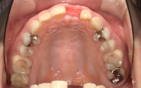 Before image