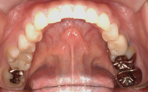 Before image