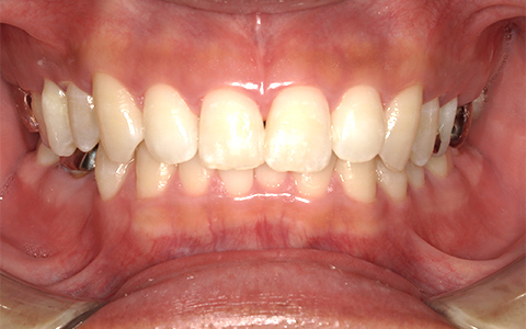 After image