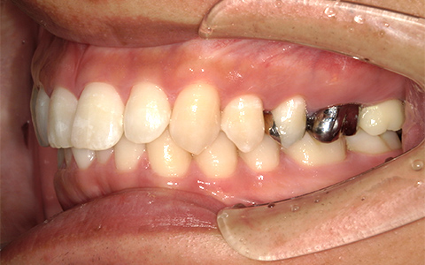 After image