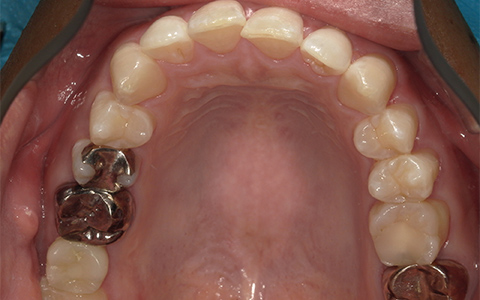 After image