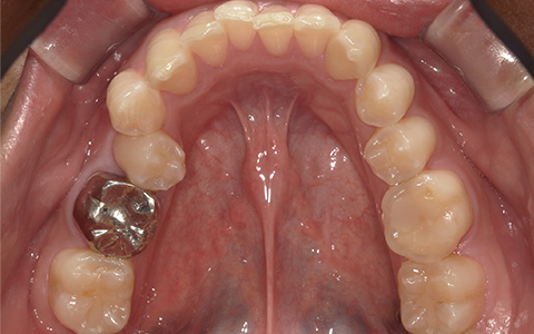 After image