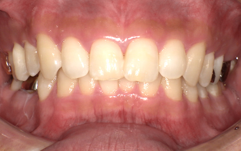 Before image